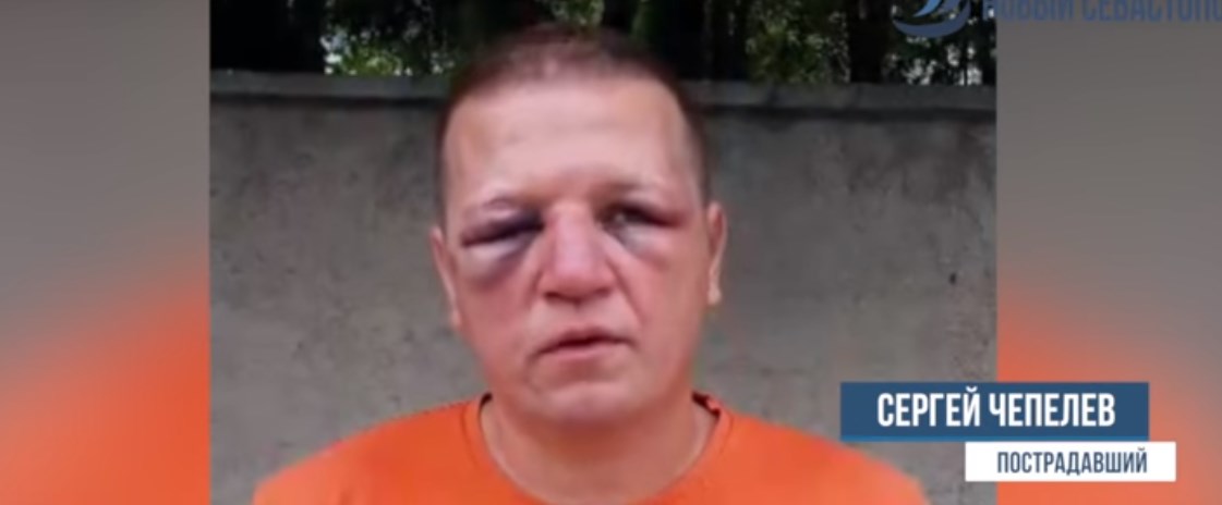 Российские полицейские жестоко избили севастопольца