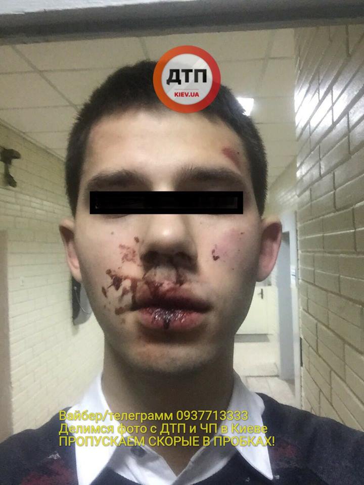 В Киеве кавказцы избили парня за замечание не ездить по тротуарам – заступиться оказалось некому